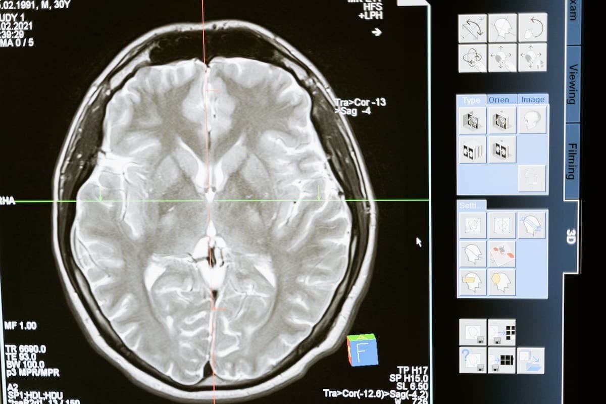 diagnostic médical