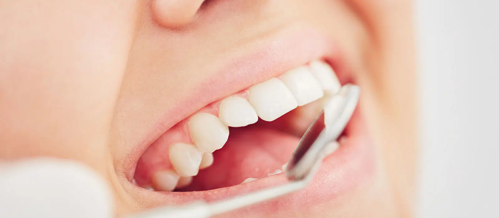 Des dents en très bonne santé